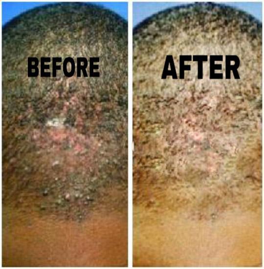 Skin Disorders in Krugersdorp - Image 2