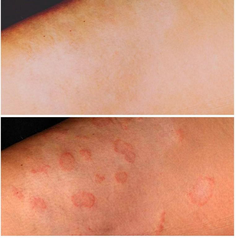 Skin Disorders in Krugersdorp - Image 5