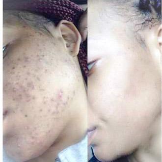 Skin Disorders in Krugersdorp - Image 10