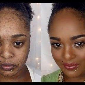 Skin Disorders in Krugersdorp - Image 14
