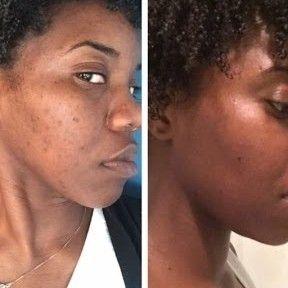 Skin Disorders in Krugersdorp - Image 19