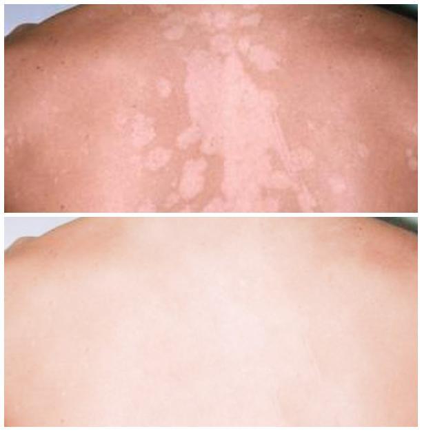 Skin Disorders in Orkney - Image 12