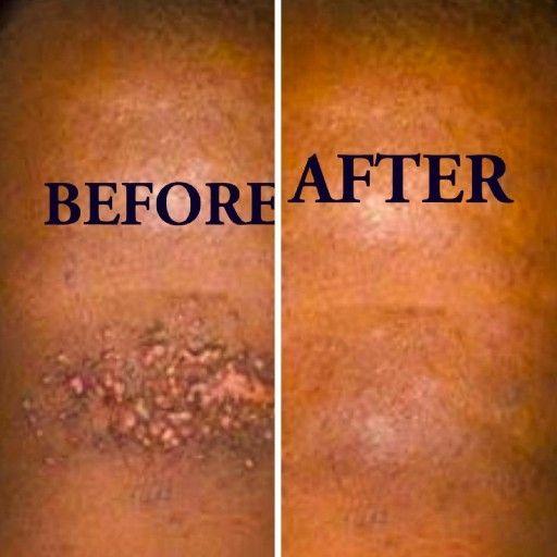 Skin Disorders in Port Elizabeth - Image 2