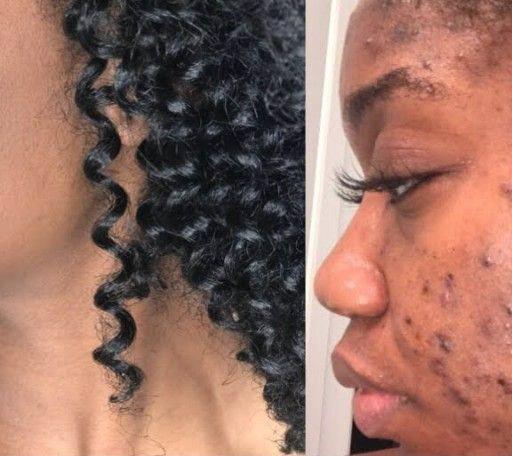 Skin Disorders in Port Elizabeth - Image 6