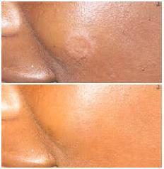 Skin Disorders in New Germany - Image 9