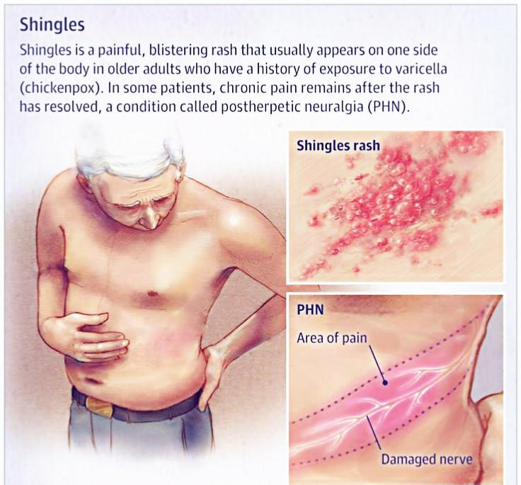 Skin Disorders in Vanderbijlpark - Image 10