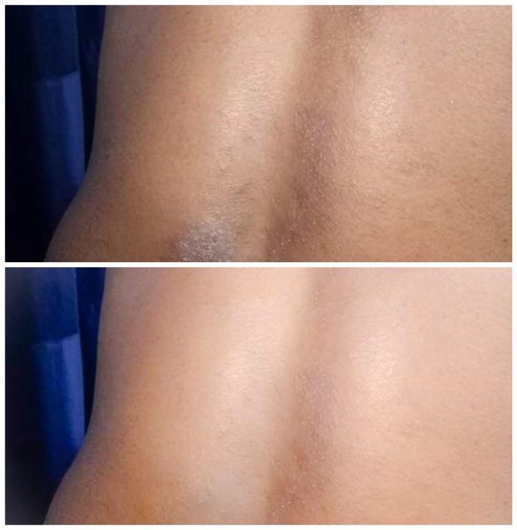 Skin Disorders in Vereeniging - Image 1