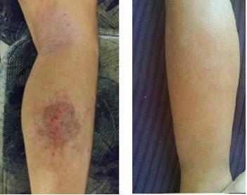 Skin Disorders in Vereeniging - Image 3