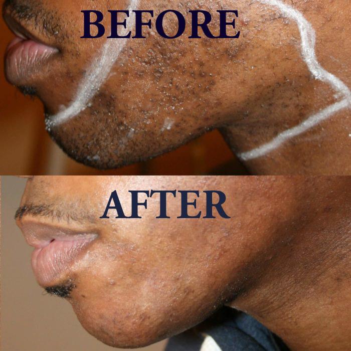 Skin Disorders in Vereeniging - Image 6