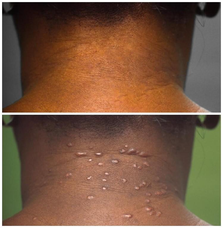 Skin Disorders in Vereeniging - Image 10
