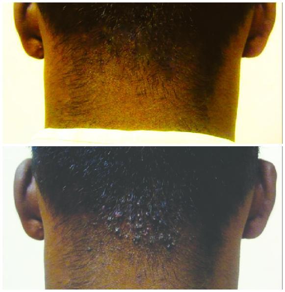 Skin Disorders in Vereeniging - Image 12