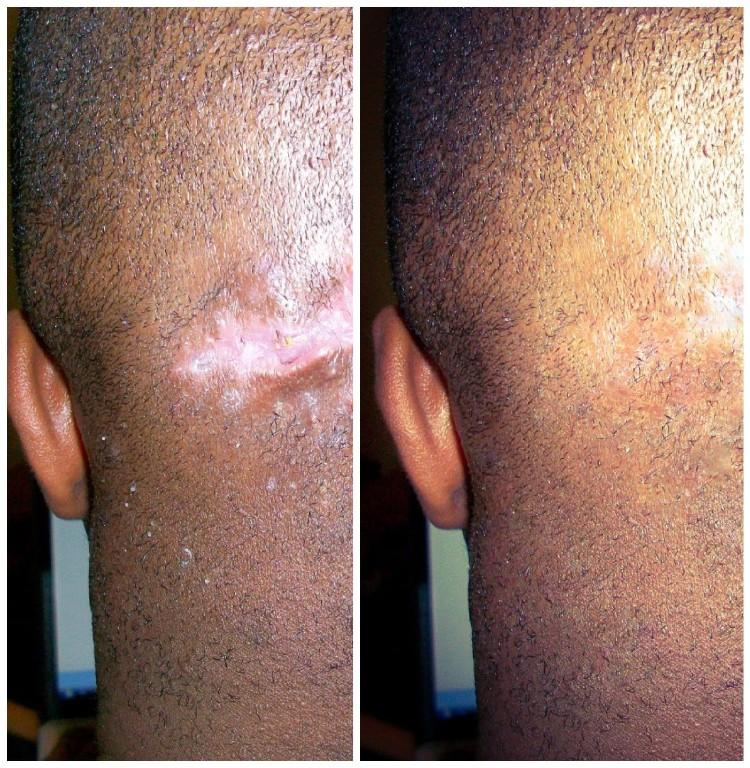 Skin Disorders in Vereeniging - Image 14