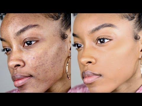Skin Disorders in Mthatha - Image 1