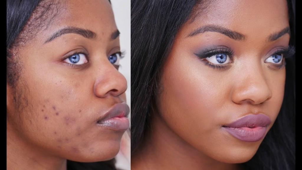 Skin Disorders in Mthatha - Image 2