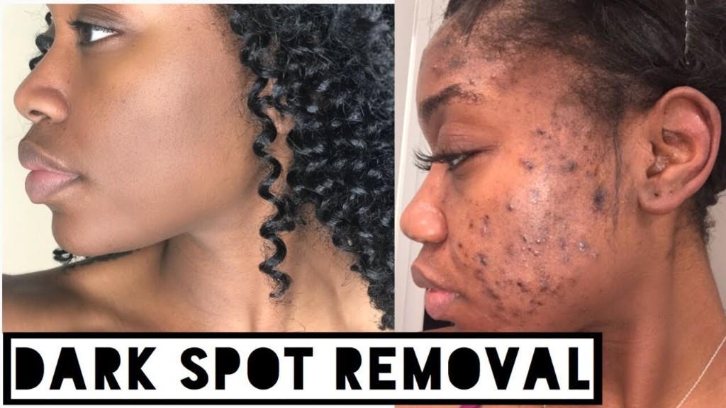Skin Disorders in Mthatha - Image 6