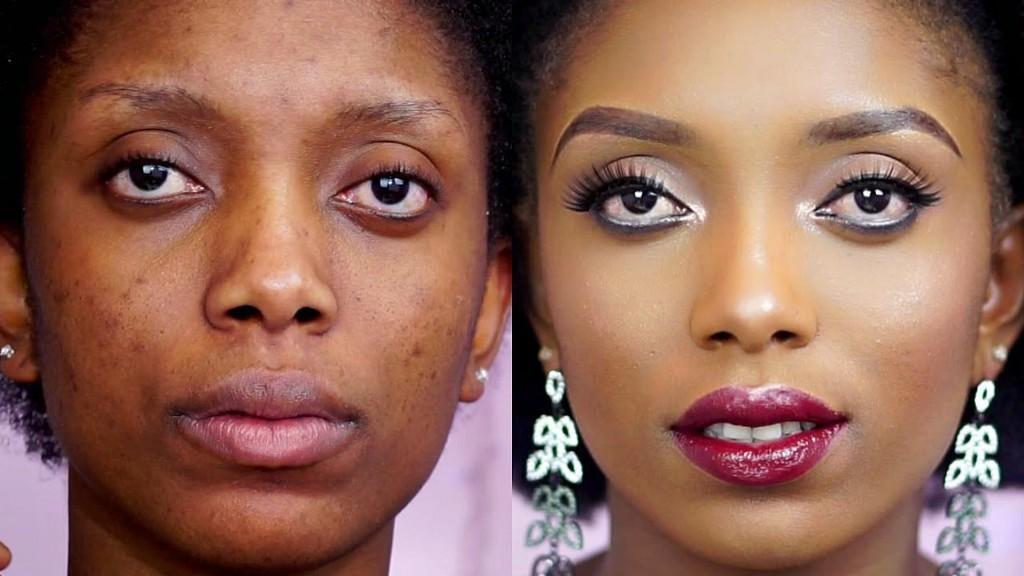 Skin Disorders in Mthatha - Image 7