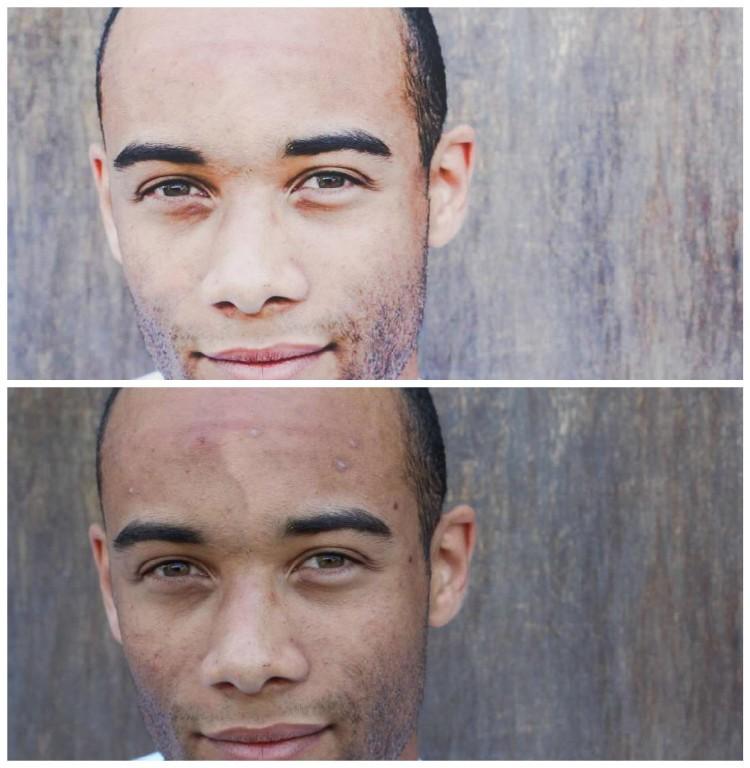 Skin Disorders in Mthatha - Image 20