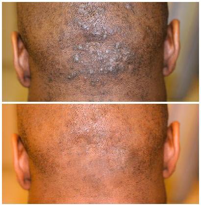 Skin Disorders in Krugersdorp - Image 3