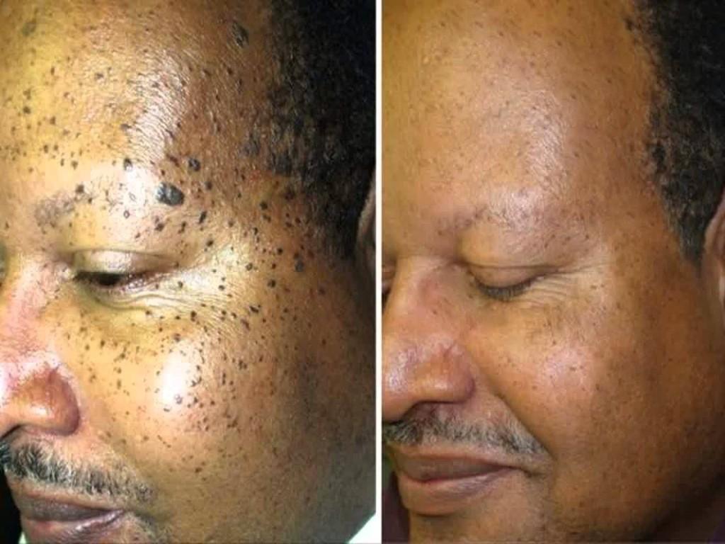 Skin Disorders in Krugersdorp - Image 6