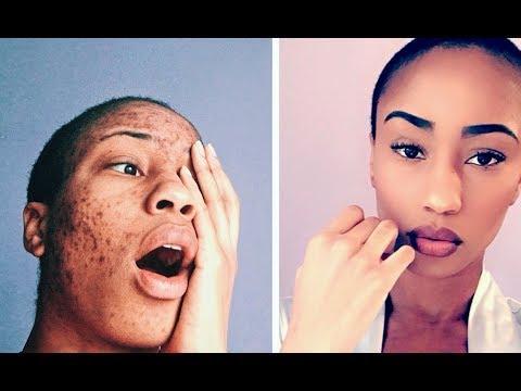 Skin Disorders in Krugersdorp - Image 16