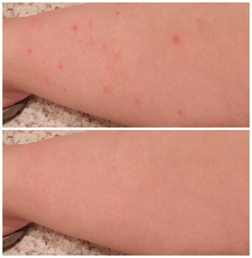 Skin Disorders in Roodepoort - Image 6