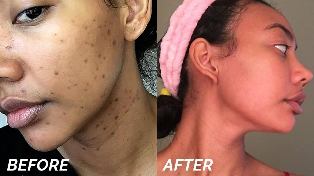 Skin Disorders in Roodepoort - Image 16