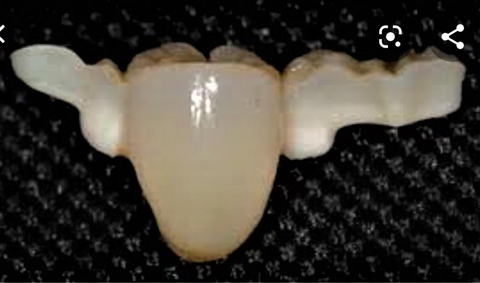 MECÁNICA Y PRÓTESIS DENTAL en Ixtapaluca - Imagen 4