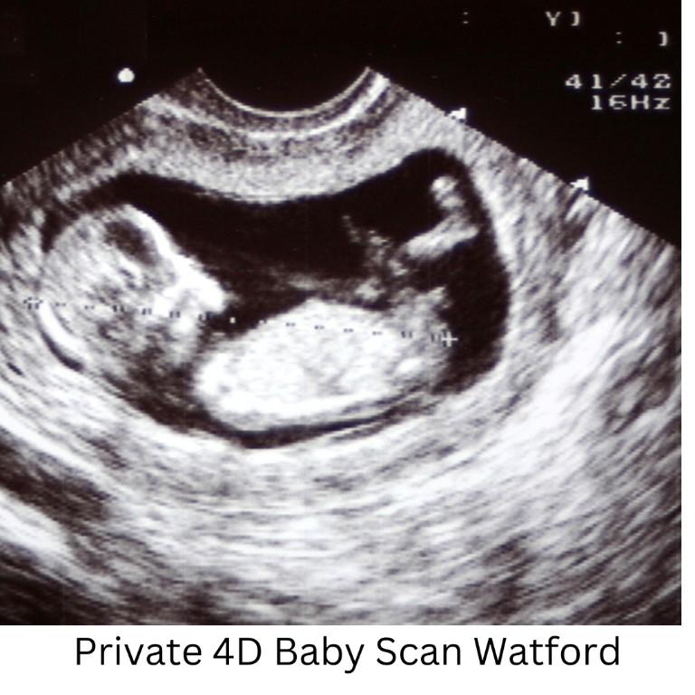 Assess Your Infant's Development Using a Private 4D Baby Scan in Hayes - Image 1