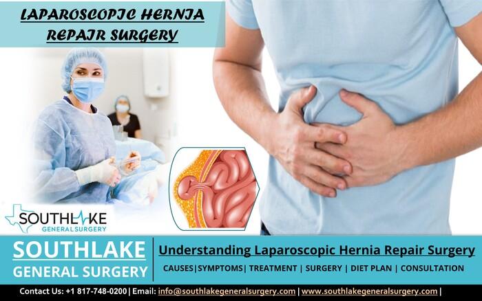 Understanding Laparoscopic Hernia Repair Surgery in Grapevine - Image 1