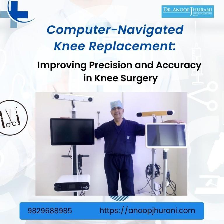 Computer-Navigated Knee Replacement in Vaishali Nagar - Image 1