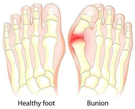 Solutions for Minimally Invasive Surgical Approaches in Boon Lay - Image 1
