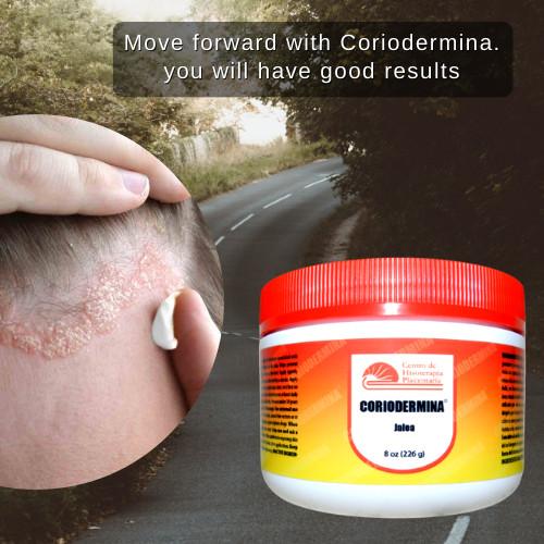 NO MAS PSORIASIS, ROSACEA AND EXZEMA. GARANTIZADO! en Miami - Imagen 3