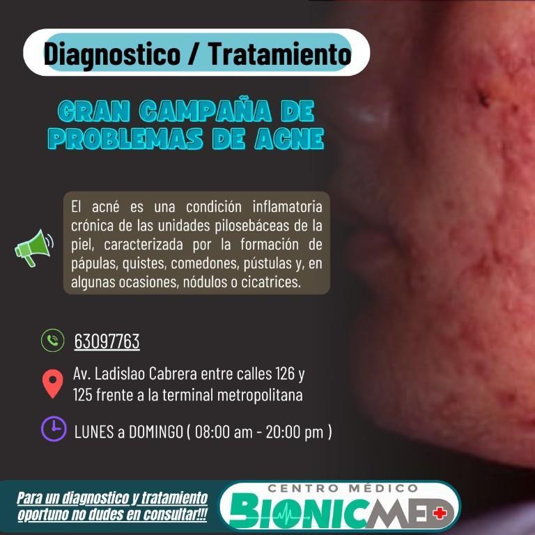 Tratamiento de acné en La Paz - Imagen 1