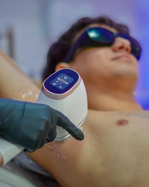 SESION DEPILACION LASER AXILAS en Bucaramanga - Imagen 1