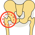 Best Orthopaedic Doctor Greater Noida in Palāni - Image 3