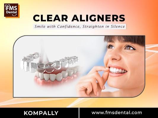 Best Invisalign Provider in Kompally - FMS Dental in Kompally - Image 1