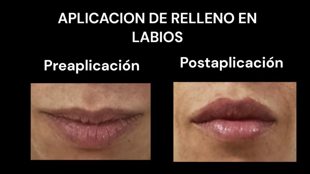 DERMATOLOGIA Y ESTETICA en Don Torcuato - Imagen 1