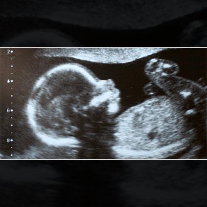 Dr Deepti Mittal -Anomaly Scan In Pune in India - Image 2