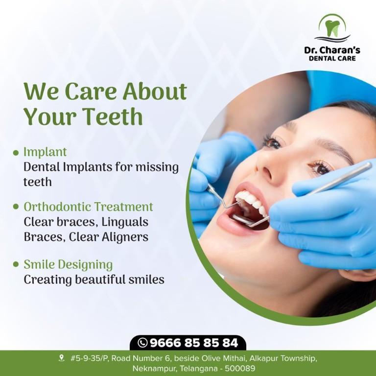 Teeth Gap Closure Treatment In Manikonda | Dr Charan's Dental in Mapple Inn Hyderabad - Image 1