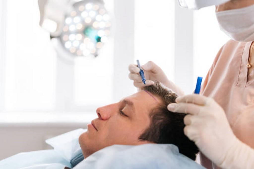 Hair Transplant in Riyadh in Taliparamba - Image 1