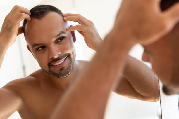 Hair Transplant in Riyadh in Taliparamba - Image 2