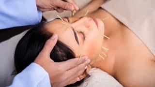 PARALISIS FACIAL -TRATAMIENTO REHABILITADOR en Perú - Imagen 3