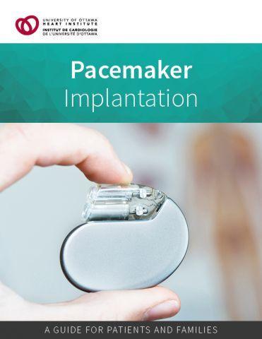 Implantation d’un Pacemaker au Cameroun - Photo 2