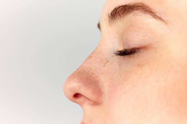 Rhinoplasty in Riyadh in Taliparamba - Image 1