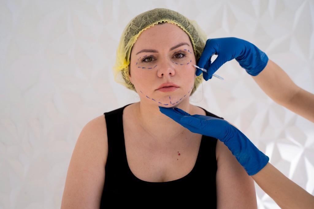 Facial Thread Lift by Experienced Doctor for Facial Thread Lift in Sagar - Image 1