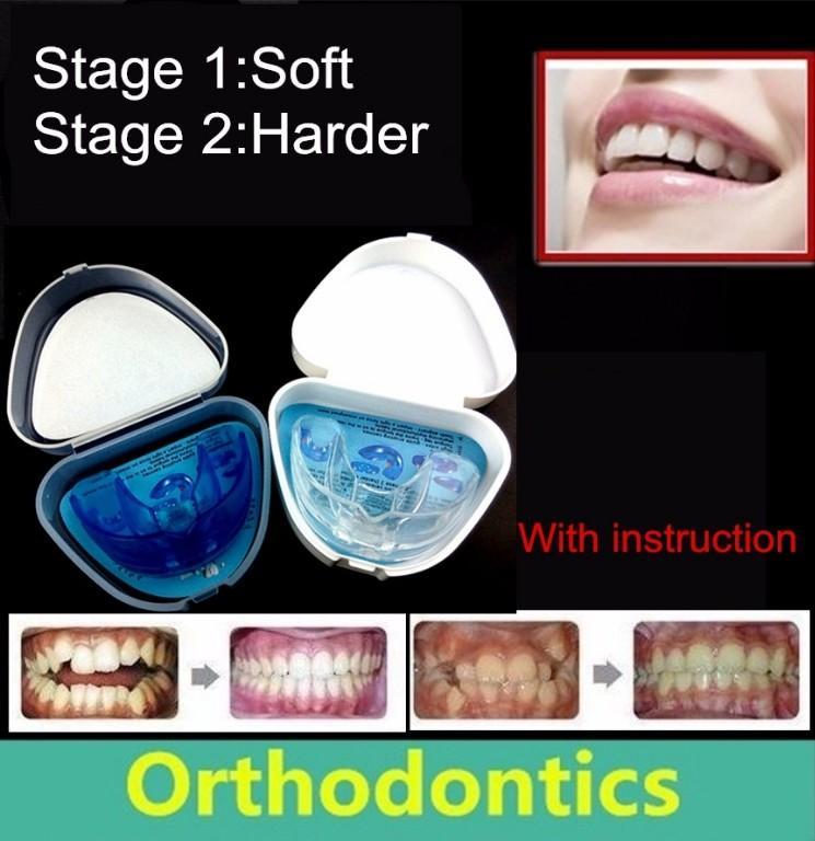 Teeth Braces R1000 in Durban - Image 1