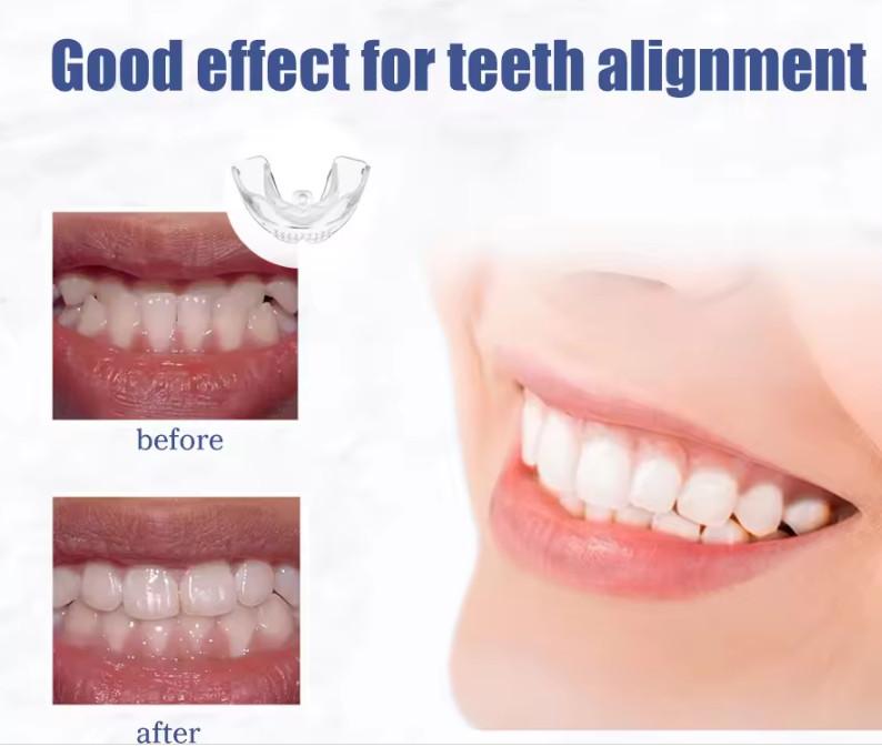 Teeth Braces R1000 in Durban - Image 2