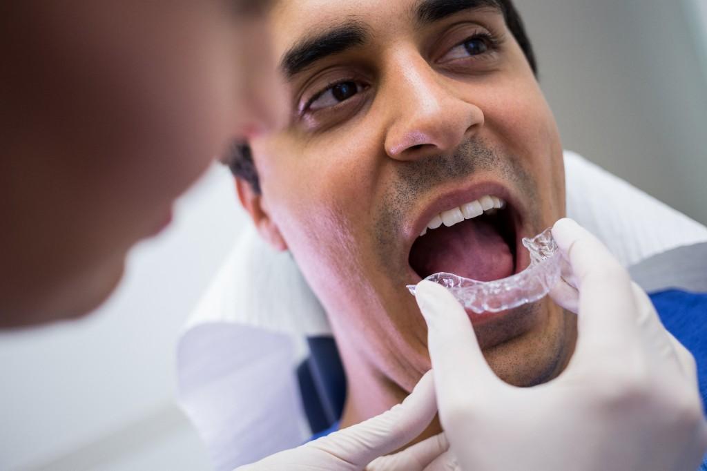How Long Does Invisalign Treatment Take in India - Image 1
