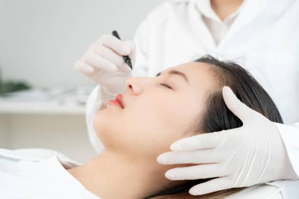 Rhinoplasty in Riyadh in Dwārka - Image 3