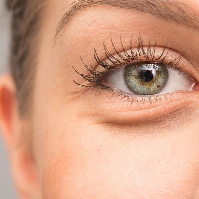 Non-Surgical Solutions for Under-Eye Pigmentation in Riyadh in Dera Ghazi Khan - Image 2